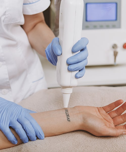 Breaking up With Your Tattoo: Why Laser Tattoo Removal Treatments Are on  the Rise - Laser NY